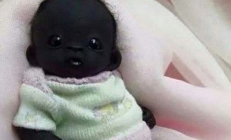 The darkest baby in the world was recently born in South Africa