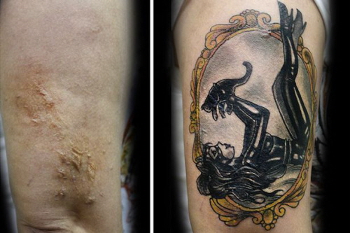 Flavia-Carvalho-free-tattoos-to-cover-scars (2)