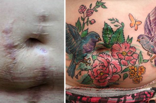 Flavia-Carvalho-free-tattoos-to-cover-scars (3)