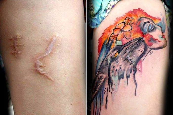 Flavia-Carvalho-free-tattoos-to-cover-scars (1)