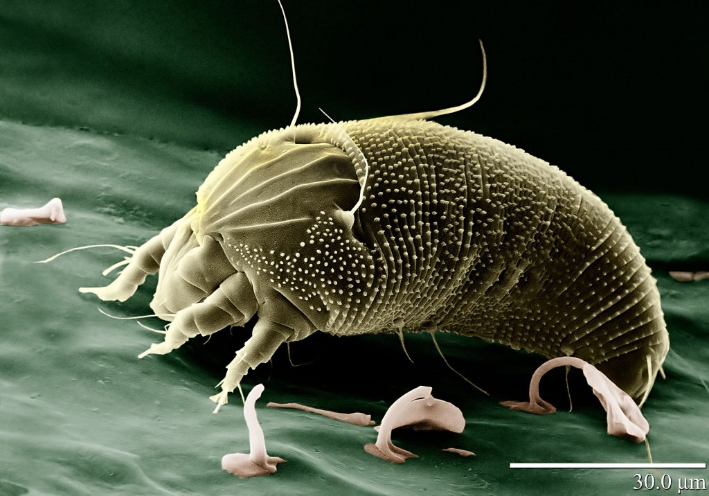 6-face-mites-are-everywhere-1024x716