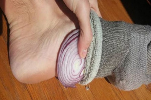 onion8