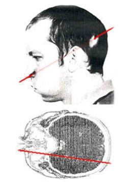 swollen-face
