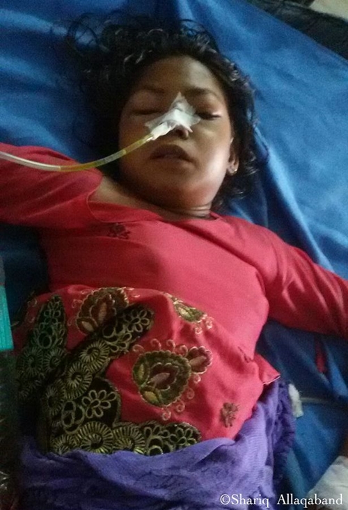 PAY-Hairball-removed-from-patient-suffering-Rapunzel-syndrome-2