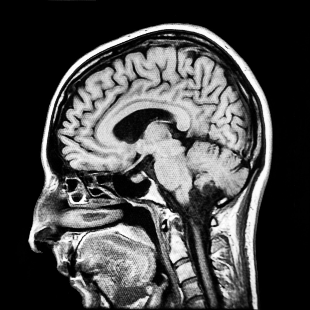 Vertical section of human brain MRI scan