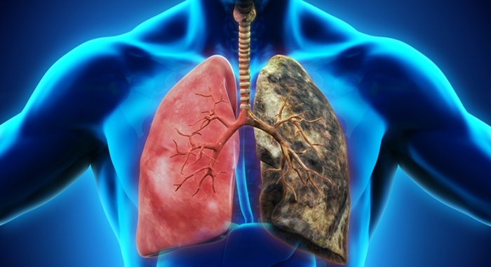 Smokers and Healthy Lung