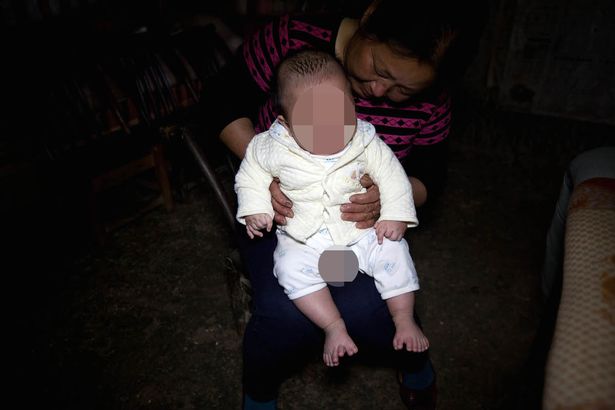 baby-with-31-fingers-and-toes-in-zhongping