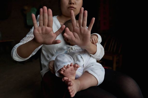 pay-baby-with-31-fingers-and-toes-in-zhongping