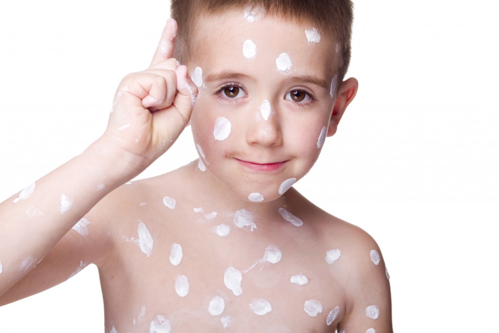 Boy with the Chickenpox's