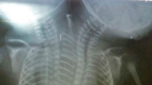 w9i828t4g7kllcqfw4h0