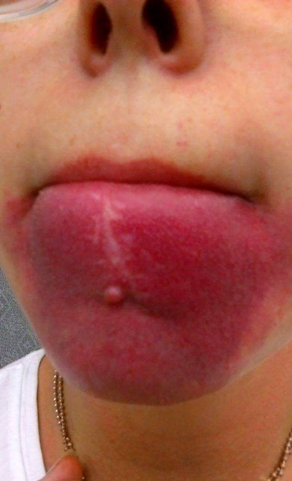 pay-birthmark-huge-lips