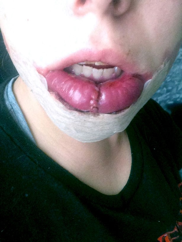 pay-birthmark-huge-lips3