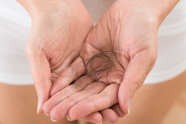 Person Hand With Loss Hair