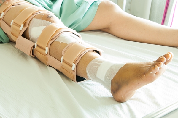 woman wearing a leg brace, Broken leg