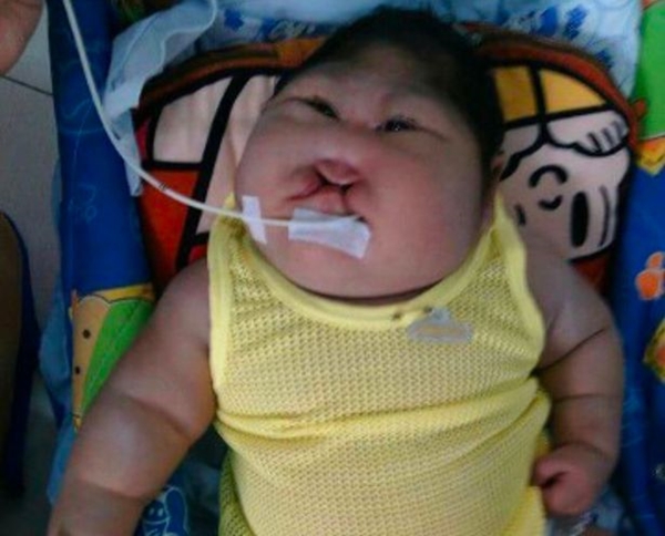 PAY-HEARTBREAKING-pictures-show-deformed-baby-that-needs-help (1)