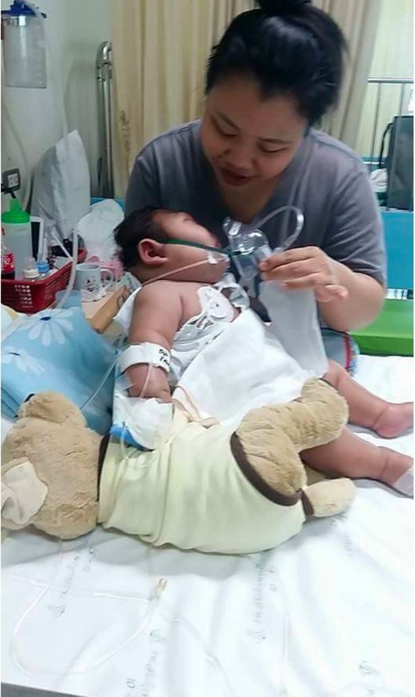 PAY-HEARTBREAKING-pictures-show-deformed-baby-that-needs-help (2)