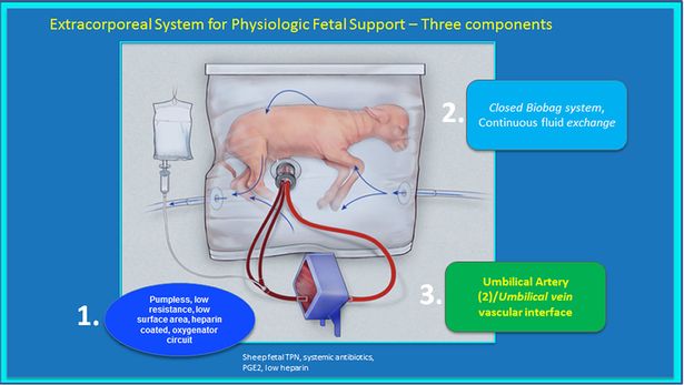 Artificial-womb-to-keep-premature-babies-alive-but-will-not-replace-human-body