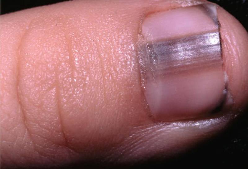 “지금부터 우리의 손톱에 집중해보자” 인체의 매우 작은 부분인 손톱으로도 전반적인 신체적 건강을 진단해볼 수 있다. 이는 온라인 매체 위티피드가 최근 공개한 내용으로, 아래의 리스트를 통해 본인�