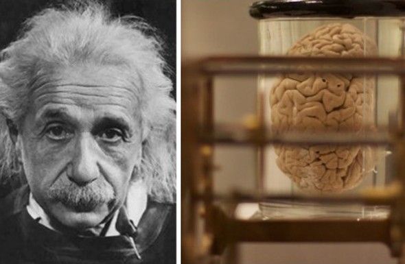 인류 역사상 최고의 천재이자 과학자로 불리는 알버트 아인슈타인(1879~1955). 많은 사람들은 그가 일반 사람들과 다른 뇌를 가지고 있을 것이라 생각하지만 한 남성은 그 사실을 직접 확인하기 위해 아인슈타인의 뇌�