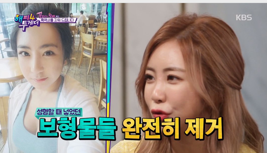 미달이 이미지