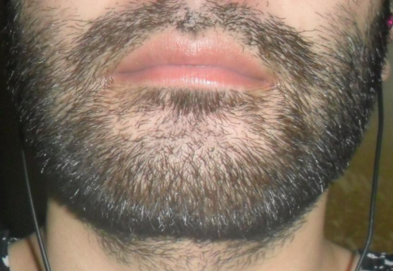 한 남성이 무려 190일 동안 수염을 기른 인증 사진을 올려 엄청난 파장을 낳고 있다. 일각에서는 “조상 중에 서양인이 있는 것이 아니냐”며 남성의 수염 상태를 보고 놀라움을 금치 못했다. 온라인이슈�