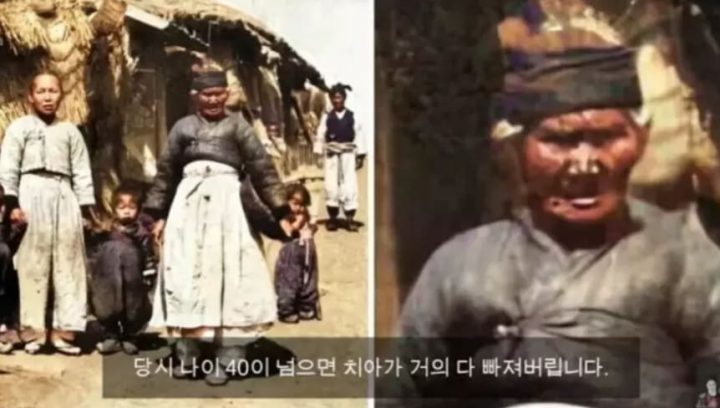 조선시대 시절 사람들의 외모가 큰 화제를 모으고 있다. 최근 한 온라인 커뮤니티에는 ‘조선시대 40대 외모’라는 제목의 게시물이 사진과 함께 올라왔다. 해당 글에는 조선시대 시절 40대 사람의 모습�