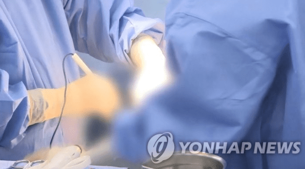 북한 여배우가 못생겨지는 성형수술을 받은 충격 이유 (+전후 차이)