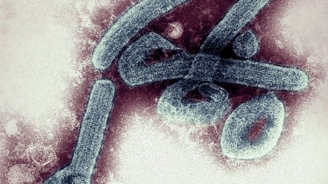 [속보] 치사율 88% 마버그바이러스 첫 감염 확인 (+증상, 백신)