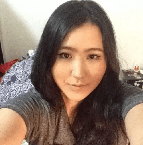 킴 카다시안 닮고 싶어 8년 간 성형 수술한 한국 여성의 충격 변화