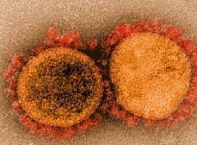 [속보] 또 중국에서'박쥐 숙주' 치사율 75% 바이러스 발견