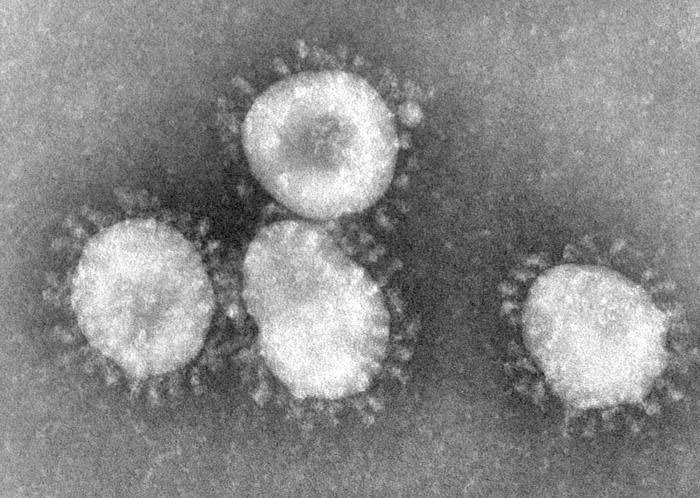 [속보] 또 중국에서'박쥐 숙주' 치사율 75% 바이러스 발견
