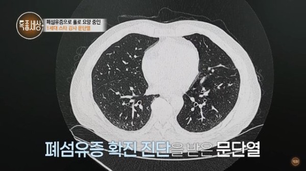 스타강사 문단열 MBN 특종세상 폐섬유증 투병 고백