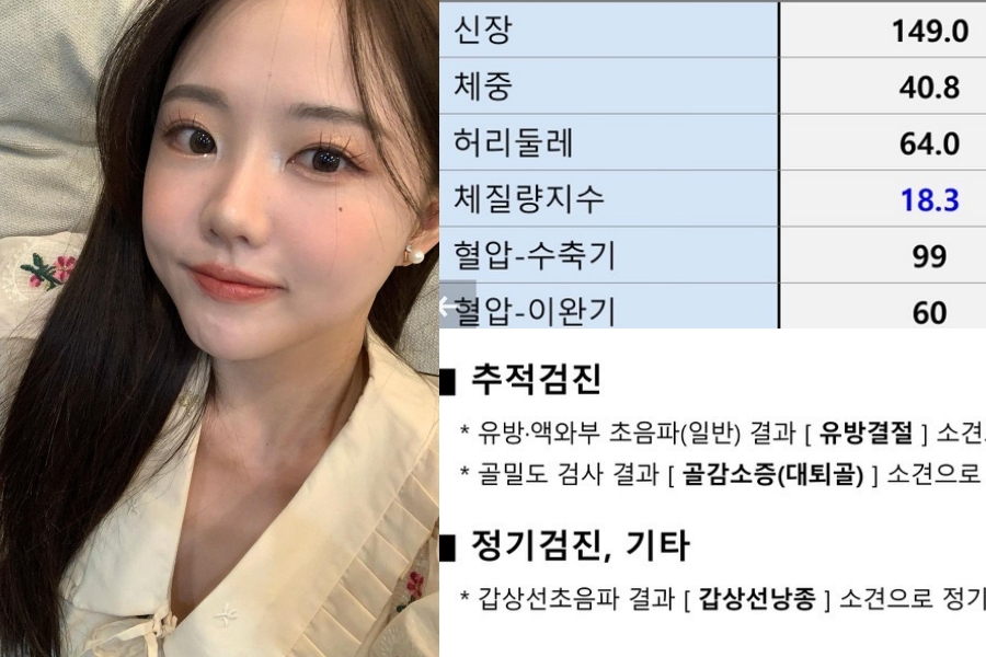 홍영기 홍영기인스타 홍영기리즈 홍영기과거 이세용