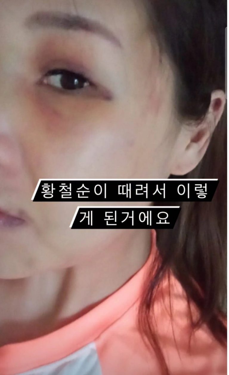 코빅 징맨 황철순 아내 폭행 영상 유출 와이프 인스타에 올라온 멍든 얼굴 내용 폭로 (사진)