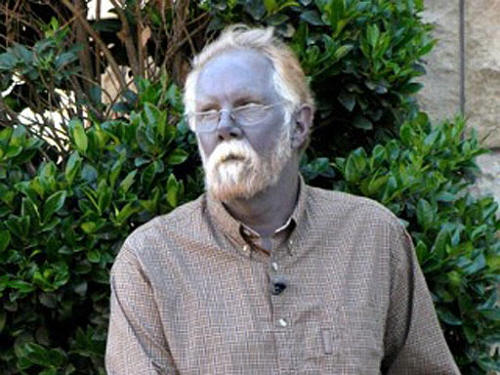 Argyria-Picture