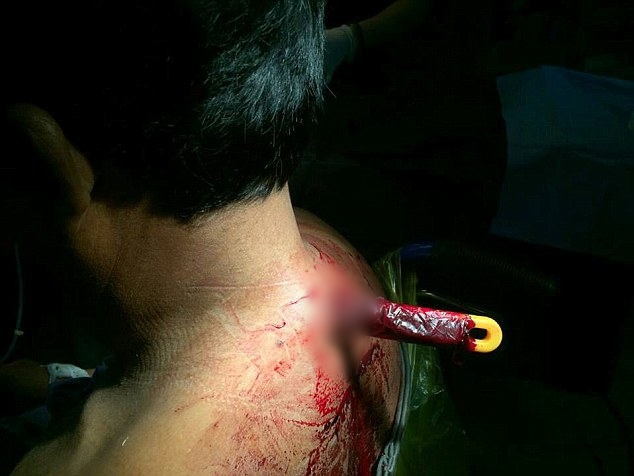 Motor taxi driver stabbed through neck by crazed passenger