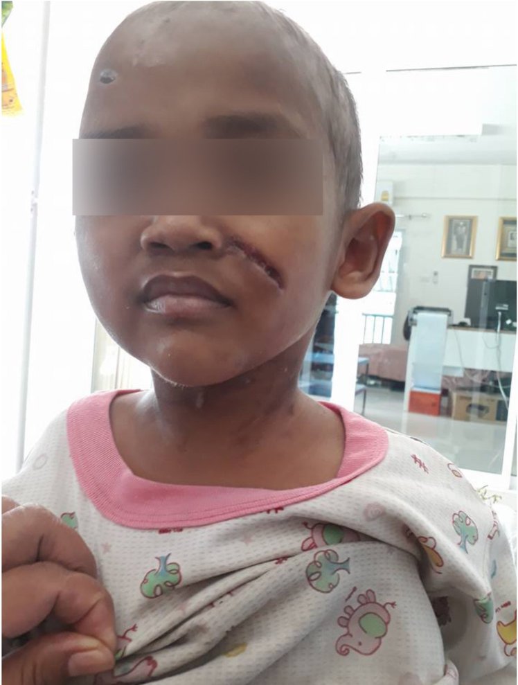 The power of social media saves 3-year-old Thai boy after father beat him