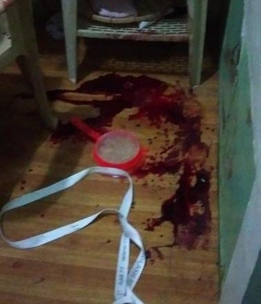 한 여성이 심각한 부상을 입고 병원 침대에 누워 범인을 지목하는 사진이 공개되면서 그 사연에 대해 많은 이들이 궁금해 하고 있다.
영국 일간 더썬은 필리핀 칼루칸에서 조안 본가레스(33)가 집에 침입한 도둑들에 의해 