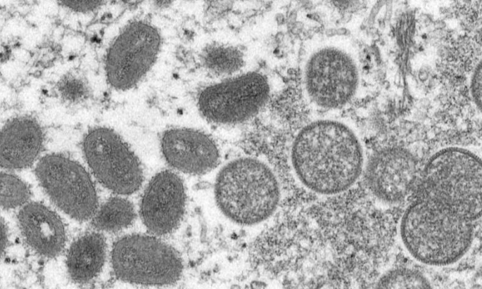 국내 원숭이두창 엠폭스 바이러스 7,8번째 확진자 발생