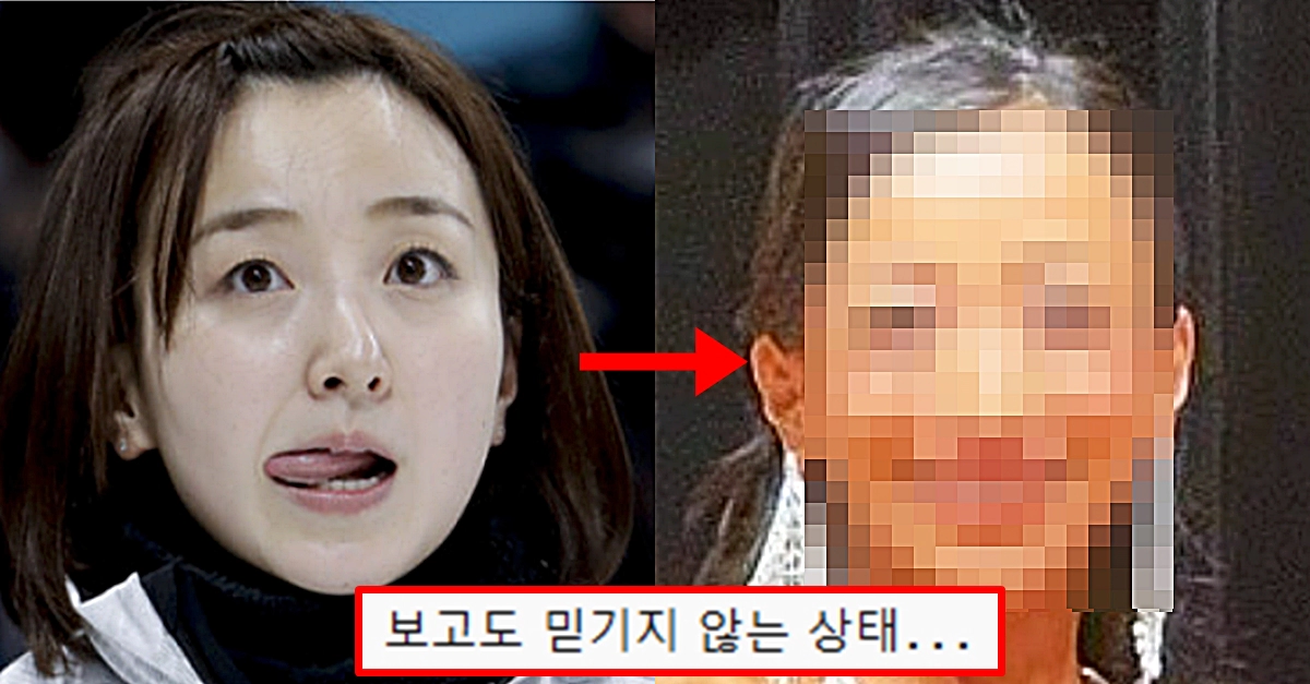 과거 박보영 닮은 꼴로 유명했던 유명 운동선수, 현재 얼굴 상태에 누리꾼 기겁했다