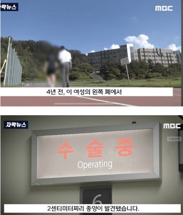 수술이후 알게된 충격적인 진실