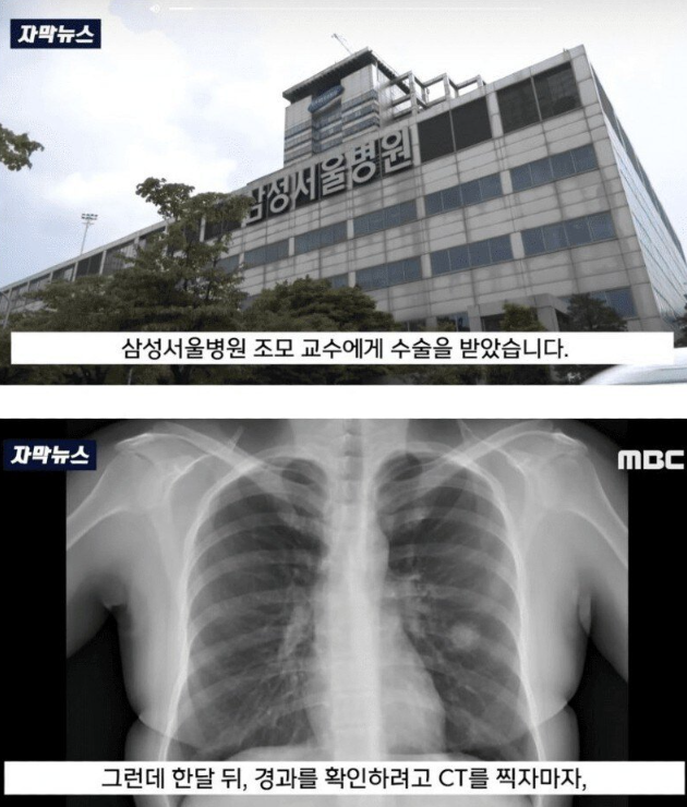 수술이후 알게된 충격적인 진실